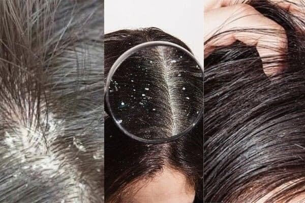 Rodite Condition Shampoo – 2-i-1 Shampoo & Conditioner 350ml