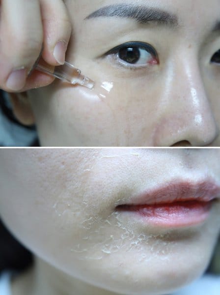 QSCELL 72hr Cell Renewal – Urte Microneedling Kur