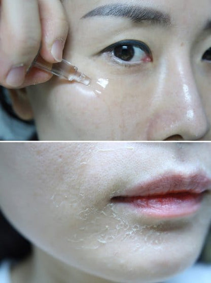 QSCELL 72hr Cell Renewal – Urte Microneedling Kur