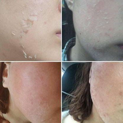 QSCELL 72hr Cell Renewal – Urte Microneedling Kur